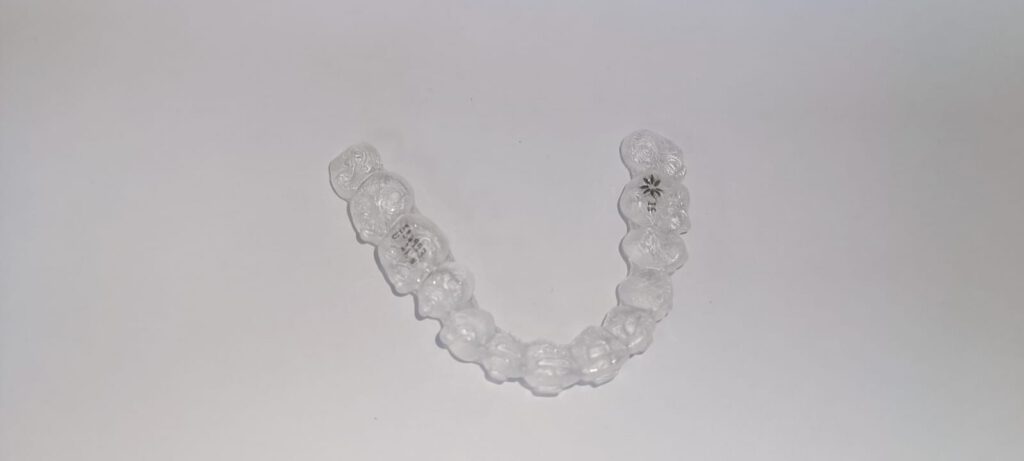 קשתית שקופה של Invisalign