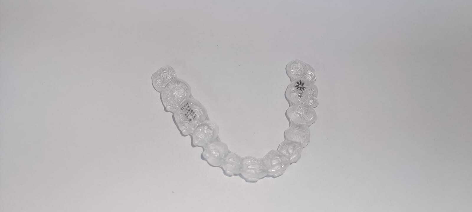 קשתית שקופה של Invisalign