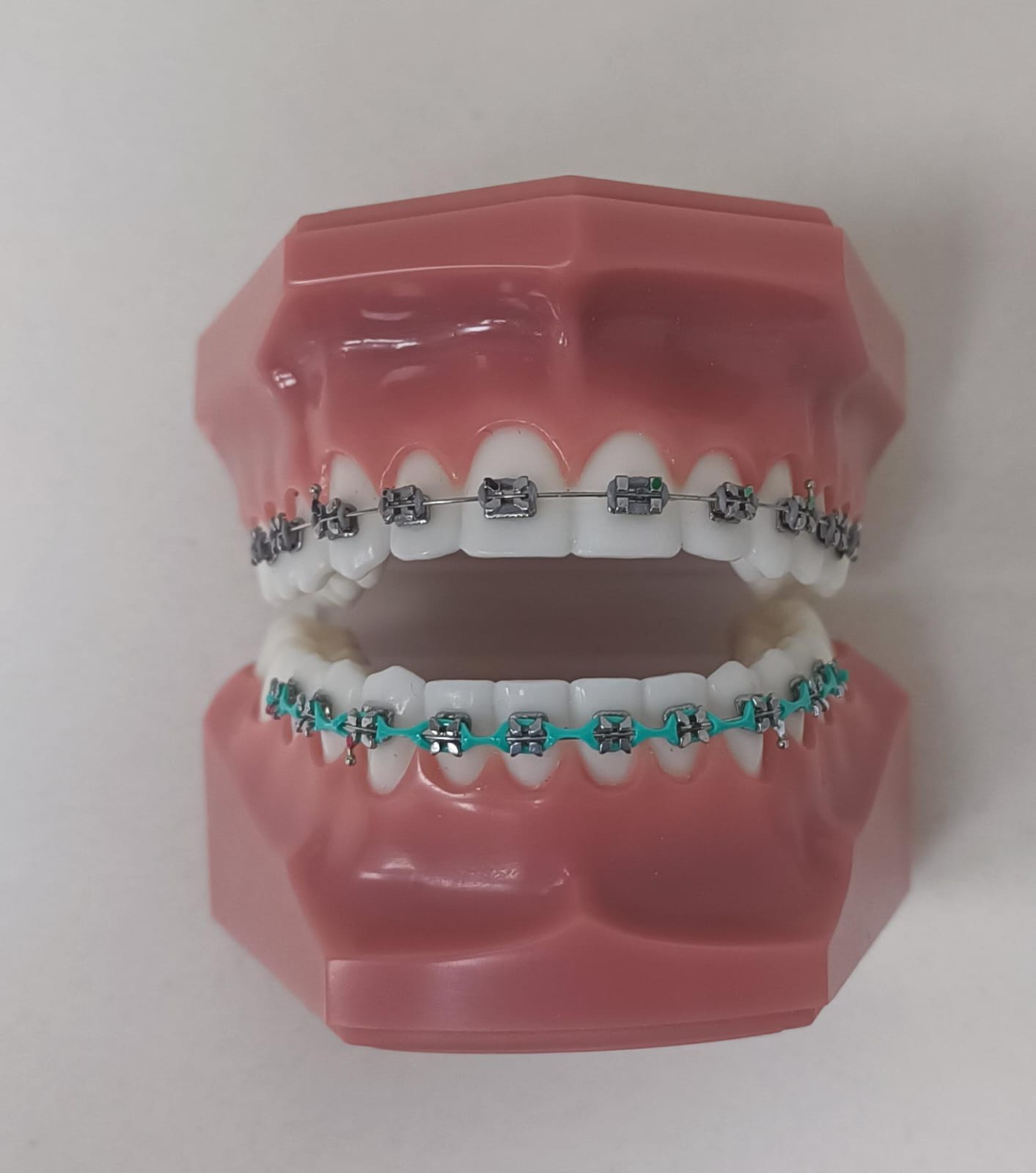 גשר עם סמכים ממתכת - גומיות כסופות למעלה ושרשרת צבעונית למטה