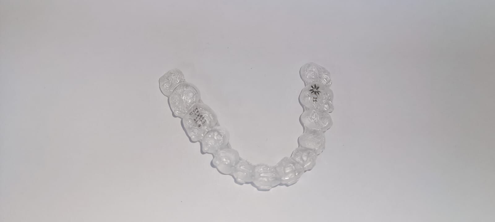 קשתית שקופה של Invisalign