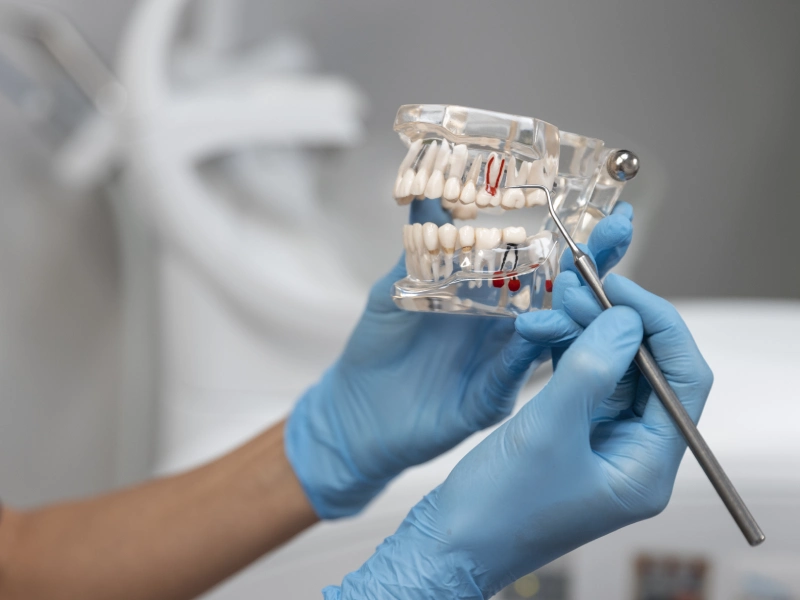 בעיות יישור שיניים ילדים